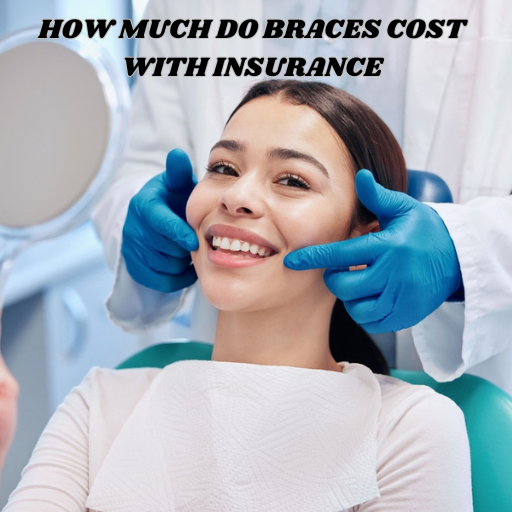 Cost of Braces